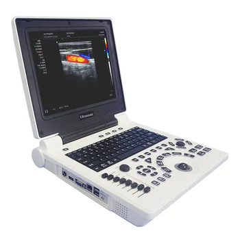 Медицинские ультразвуковые инструменты, Китай, самый дешевый цветной допплеровский акушерско-гинекологический портативный ультразвуковой сканирующий аппарат